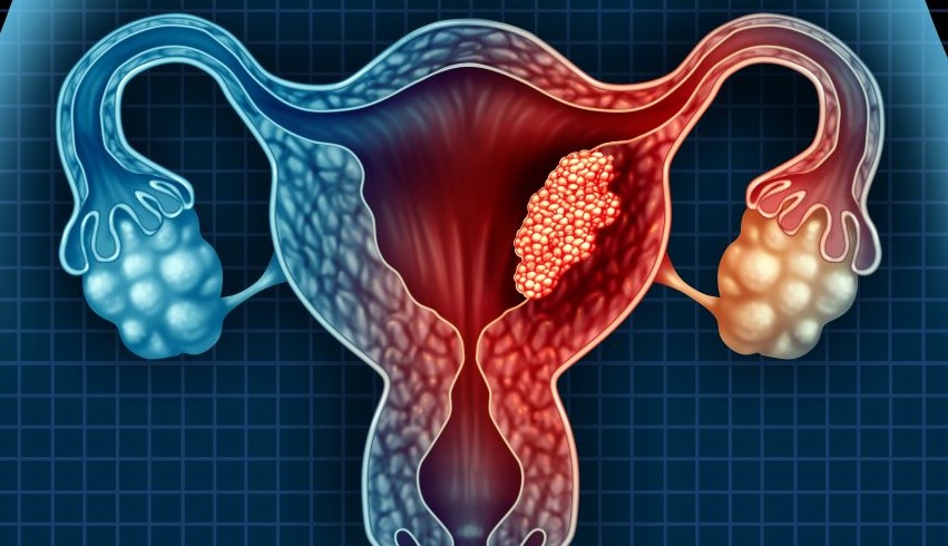 Grafik einer Gebärmutter